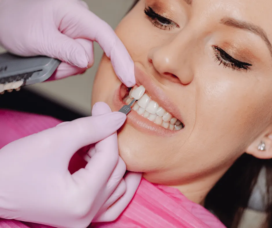 Veneers & Laminates for miscoloured/ chipped teeth at best dental clinic in BTM layout, Bangalore
