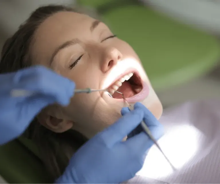 Teeth Scaling at best dental clinic in BTM layout, bangalore