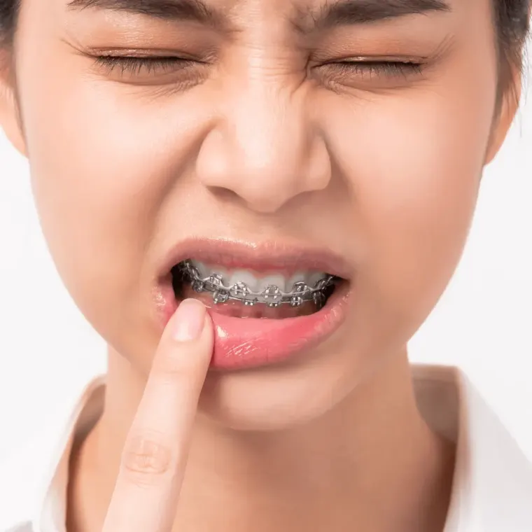 How to Deal with Braces Pain — Dentick Dental Care, Bengaluru