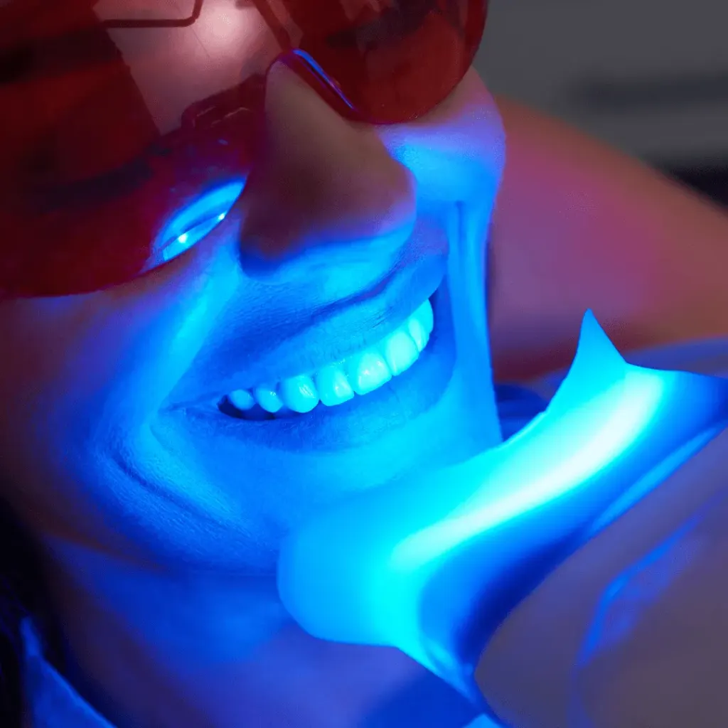 Teeth Whitening guide