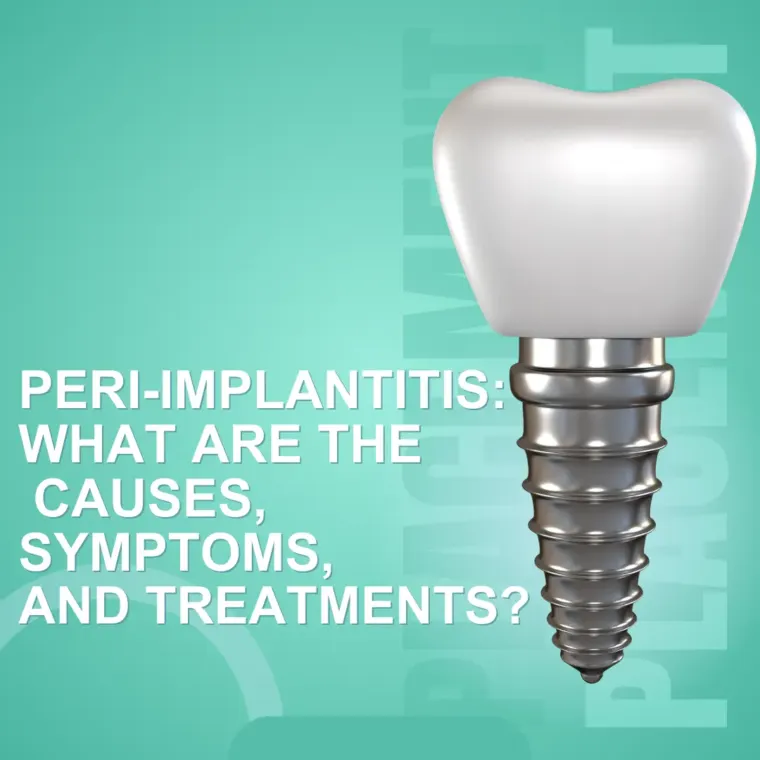 Peri-Implantitis Causes, Symptoms, Treatments