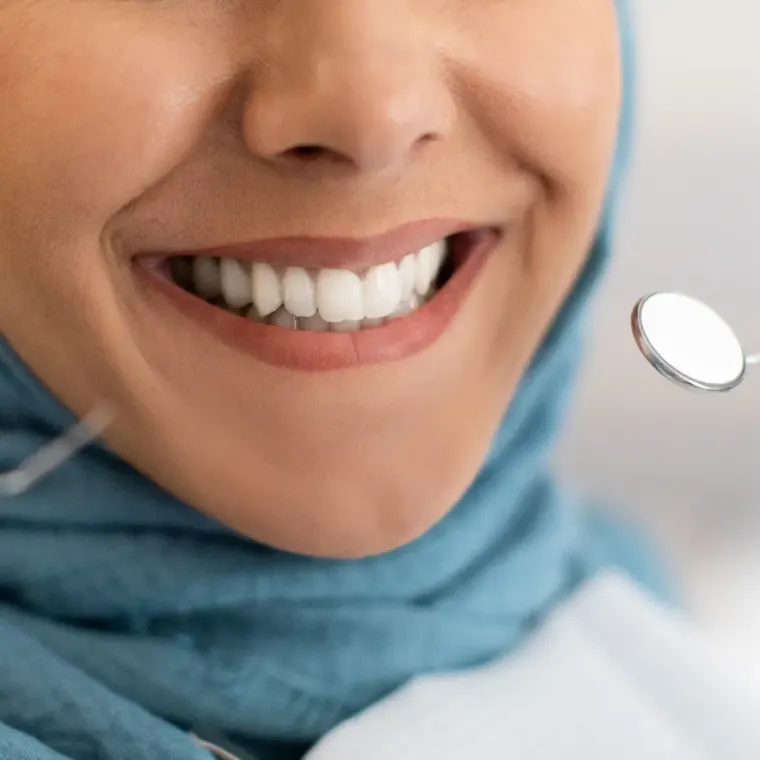 Smile Makeover