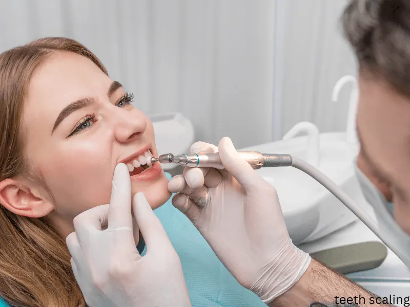 Dental scaling and polishing procedure to remove stains and tartar.