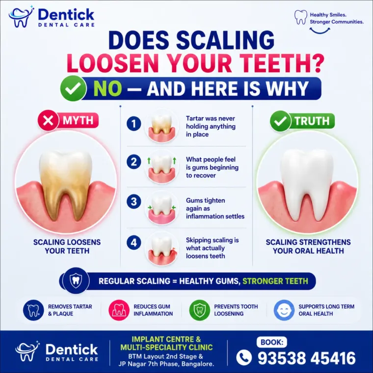 A poster answering Does scaling loosen your teeth?