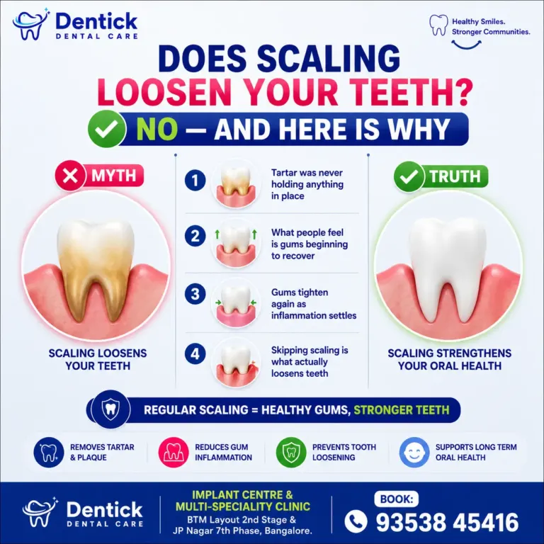 A poster answering Does scaling loosen your teeth?