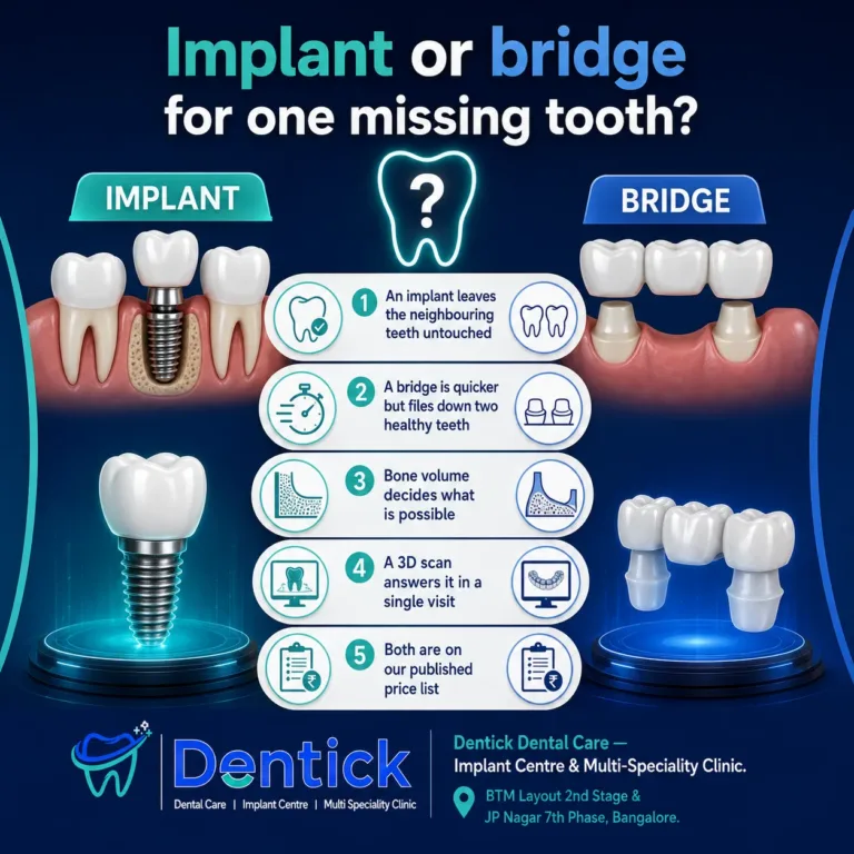 Implant or bridge for one missing tooth — Dentick Dental Care, Bengaluru