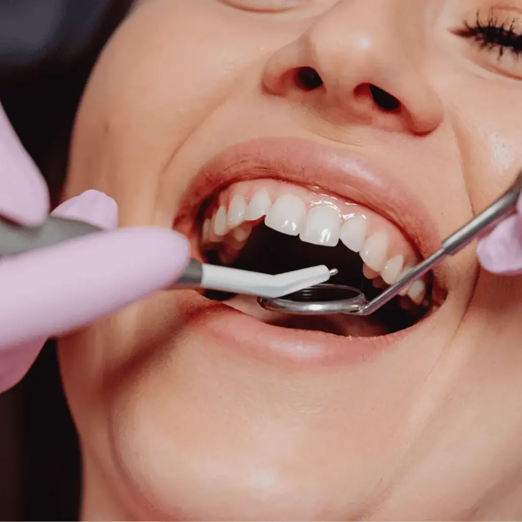 Composite bonding single tooth — Dentick Dental Care, Bengaluru