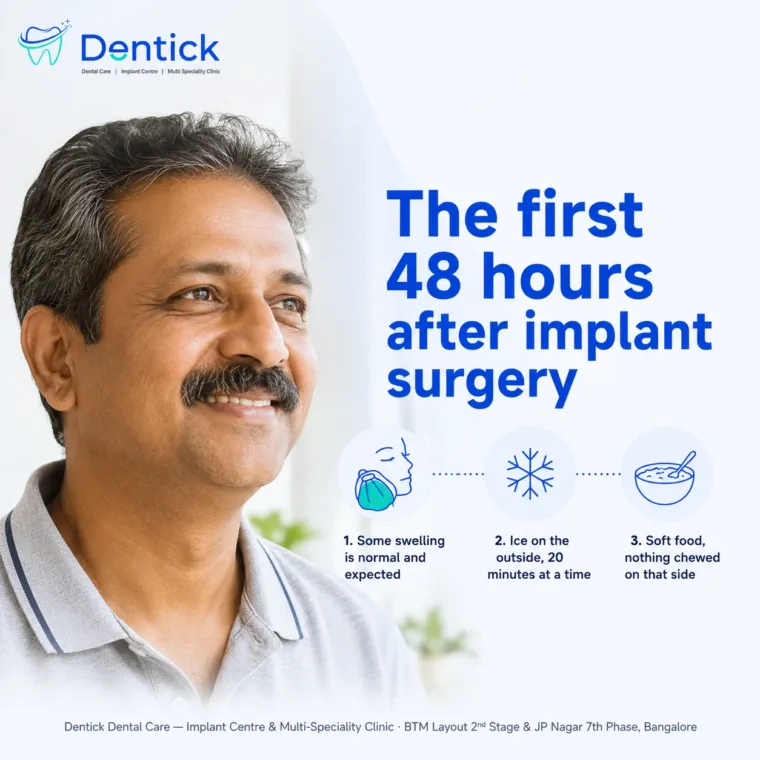 Dental implant bangalore implant aftercare BTM layout 2026 08 — Dentick Dental Care, Bengaluru