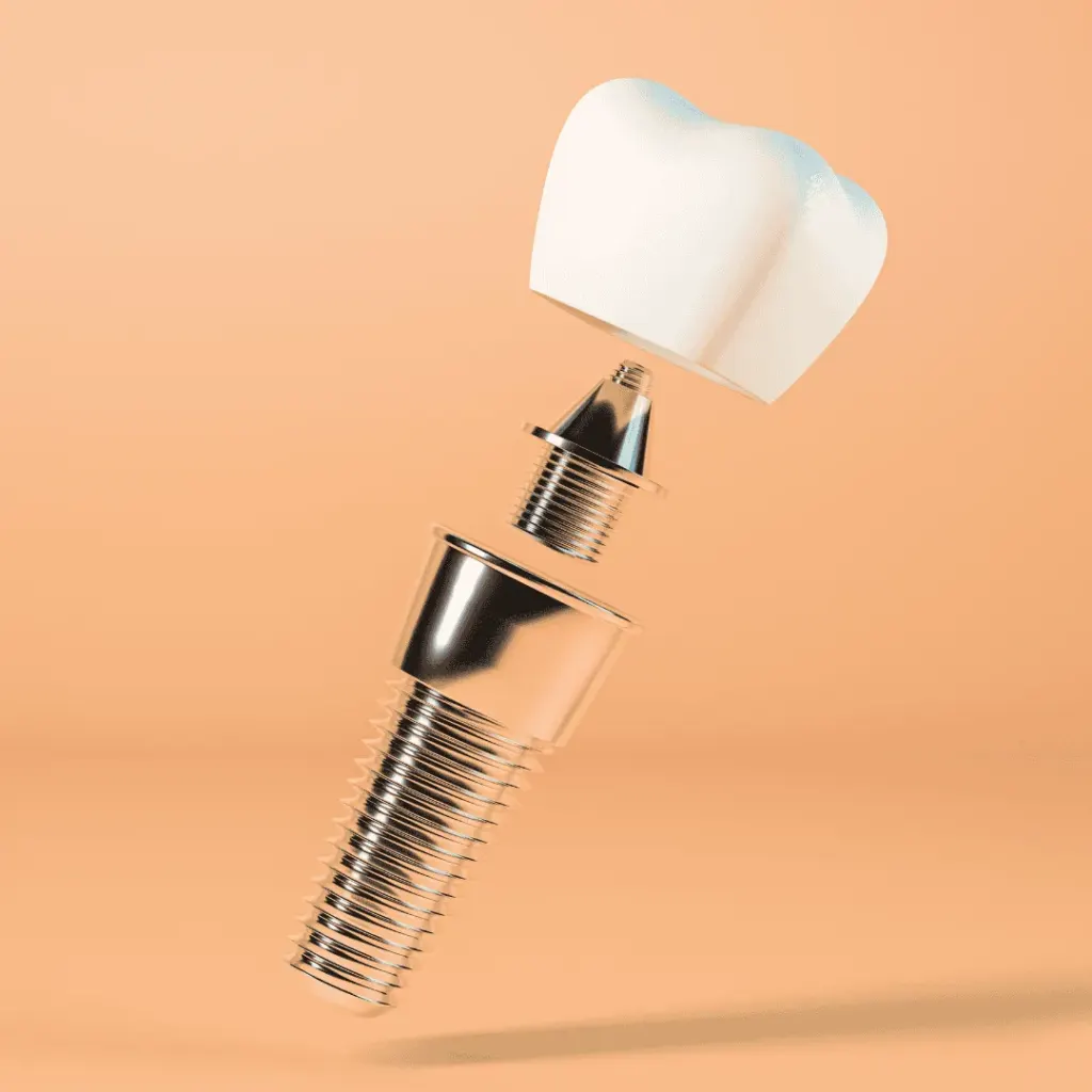 CBCT-guided dental implant treatment at Dentick Dental Care, Bengaluru