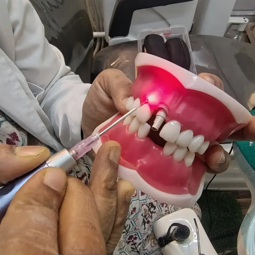 Gum depigmentation laser — Dentick Dental Care, Bengaluru