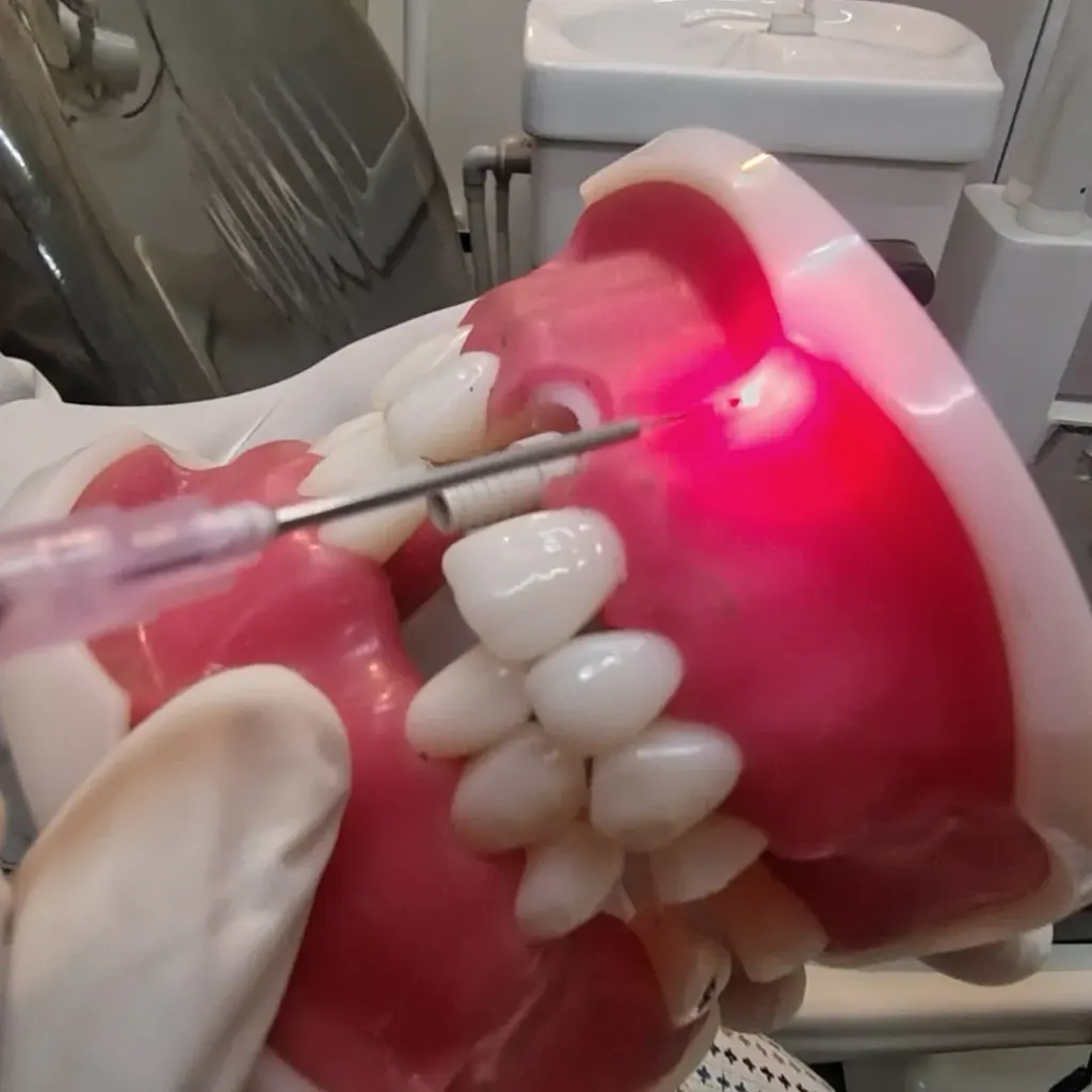 Laser frenectomy tongue lip tie — Dentick Dental Care, Bengaluru