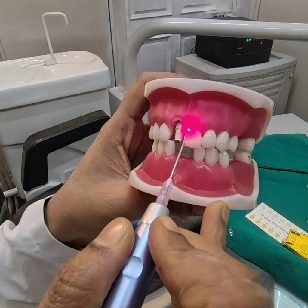 Laser gum disease treatment at Dentick Dental Care, Bengaluru