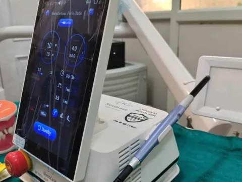 Novolase Laser Dentistry Unit at Dentick Dental Care