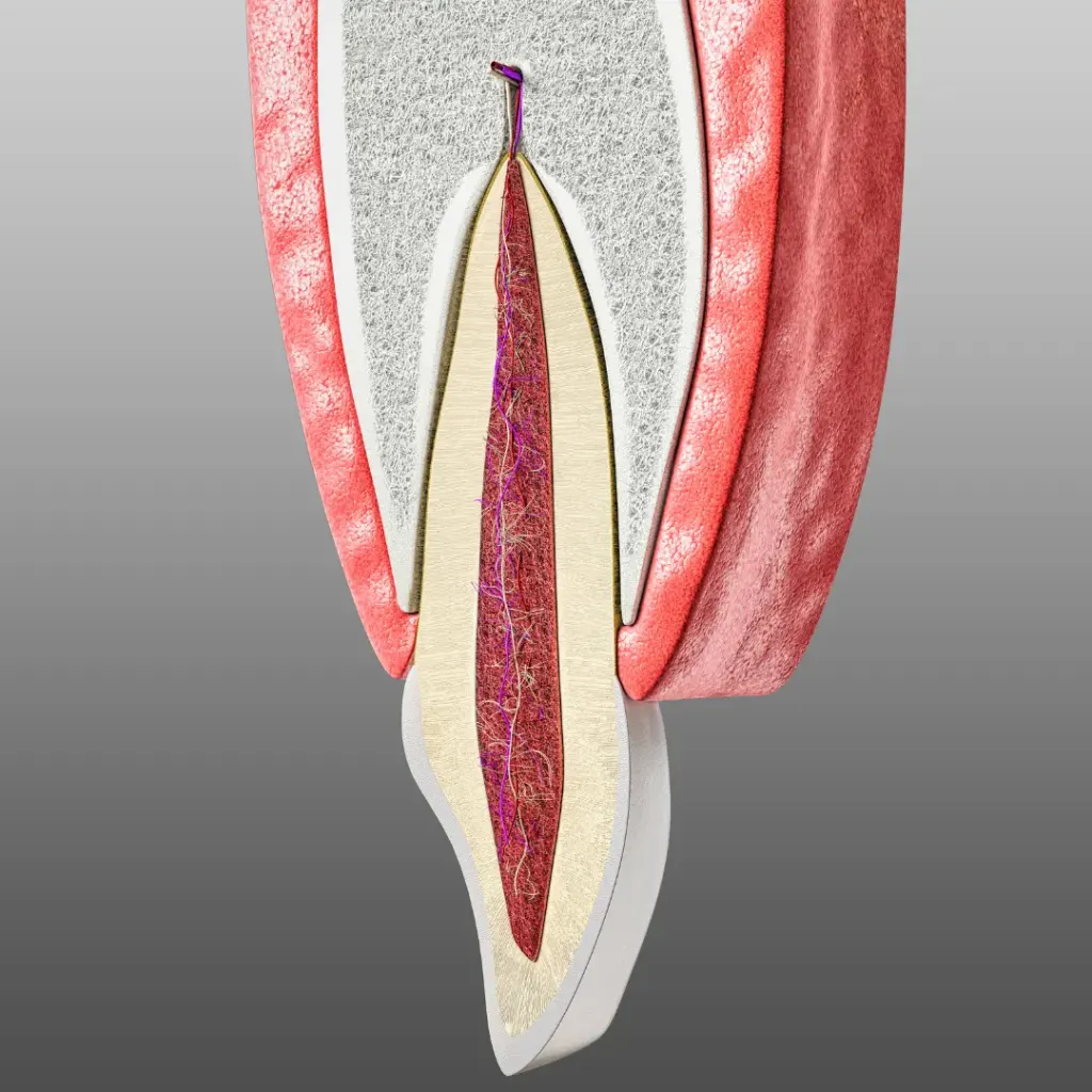 Root canal treatment on a front tooth at Dentick Dental Care, Bengaluru