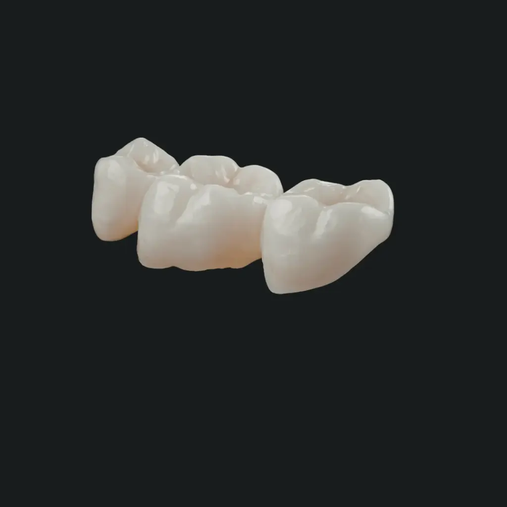 Zirconia dental crown fitted at Dentick Dental Care, Bengaluru